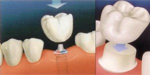 Dental-Treatment02